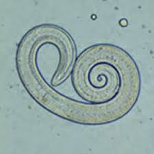 Mikroskopický snímek svalovce stočeného (Trichinella spiralis)